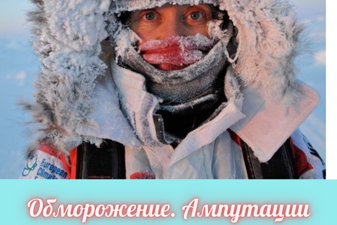 Обморожение. Ампутации могло бы не быть!