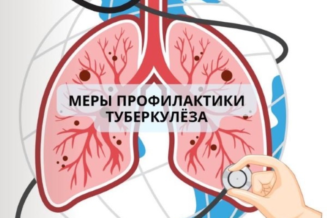 Меры профилактики туберкулеза