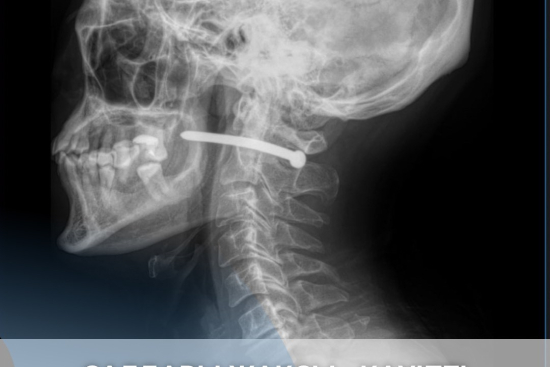 Салдары жақсы - қауіпті кездейсоқтық