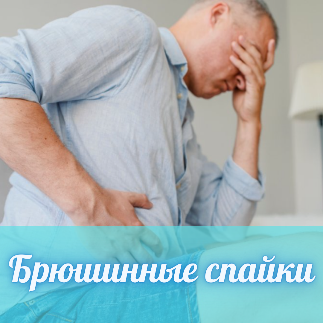 Спаечная болезнь брюшной полости 